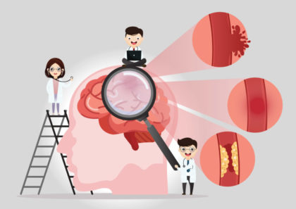 Tecnologia Derrames Cerebrales